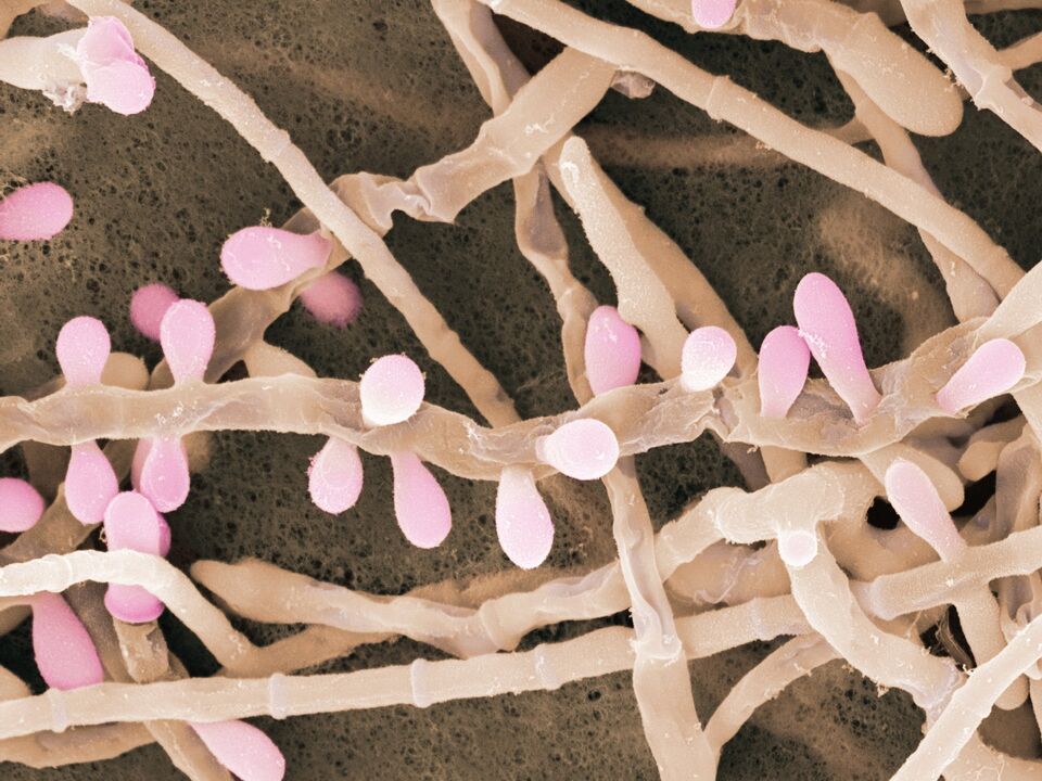 Το Trichophyton rubrum είναι ένας τύπος μύκητα που προσβάλλει το δέρμα των ποδιών.